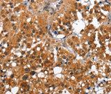 Anti-Human/Mouse CAMK1D Antibody - ABMIUM