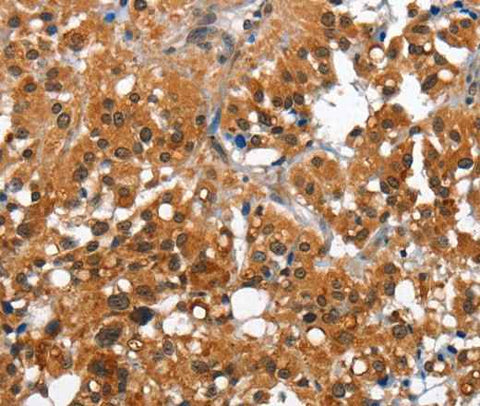 Anti-Human/Mouse CAMK1D Antibody