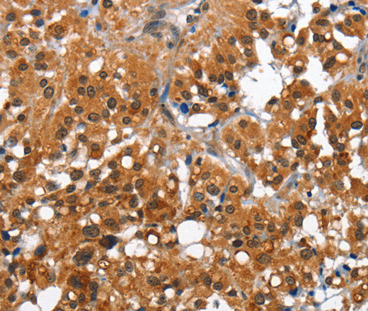 Anti-Human/Mouse CAMK1D Antibody - ABMIUM