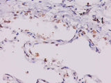 Anti-Human CCL11 Antibody - ABMIUM