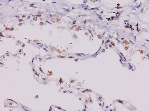 Anti-Human CCL11 Antibody - ABMIUM
