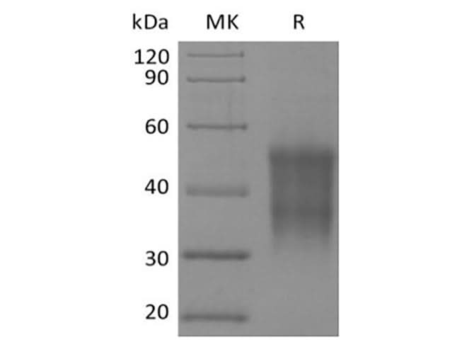 Recombinant Rhesus Macaque CD47/IAP/OA3 (N-6His-Flag) - ABMIUM