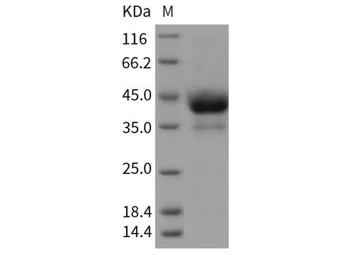 Recombinant Rat ALK4/ACVR1B Protein (Fc Tag) - ABMIUM