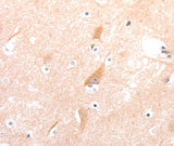 Anti-Human/Mouse/Rat CELSR2 Antibody - ABMIUM