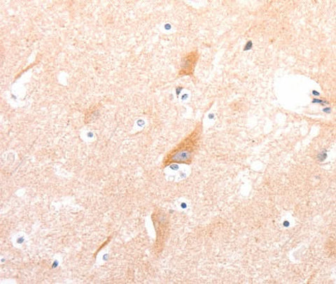 Anti-Human/Mouse/Rat CELSR2 Antibody - ABMIUM