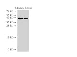 Anti-Human AMACR Antibody - ABMIUM
