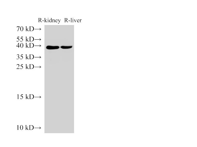 Anti-Human AMACR Antibody - ABMIUM