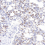 Immunohistochemistry analysis of paraffin-embedded mouse inflammatory lung using MMP9 Monoclonal Antibody at dilution of 1:400.