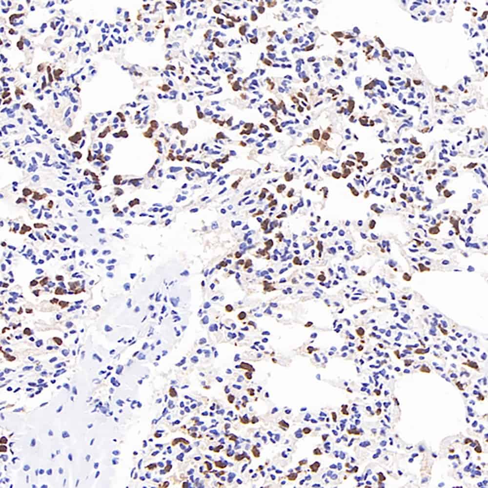Immunohistochemistry analysis of paraffin-embedded mouse inflammatory lung using MMP9 Monoclonal Antibody at dilution of 1:400.