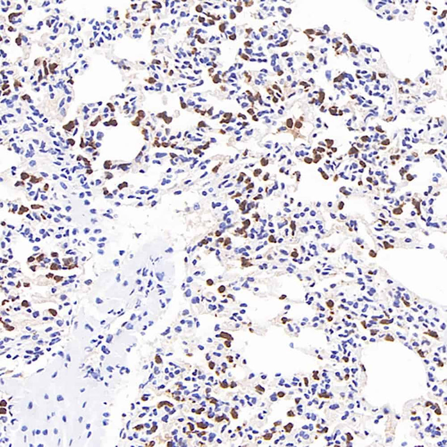 Immunohistochemistry analysis of paraffin-embedded mouse inflammatory lung using MMP9 Monoclonal Antibody at dilution of 1:400.