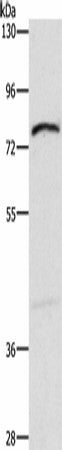 Western blot analysis of Mouse intestinum tenue tissue using XPNPEP1 Polyclonal Antibody at dilution of 1:600