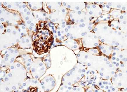 Anti-Mouse CD38 Antibody [B420] - ABMIUM