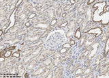 Anti-Human BCL2L1 Antibody [A1098] - ABMIUM