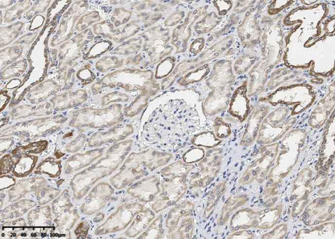 Anti-Human BCL2L1 Antibody [A1098] - ABMIUM