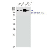 Western blot detection of DGKZ/DGK-zeta in Hela,A549,HL-60,U2OS cell lysates using DGKZ/DGK-zeta Rabbit mAb(1:1000 diluted).Predicted band size:104kDa.Observed band size:124,114kDa.