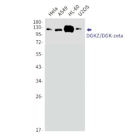 Western blot detection of DGKZ/DGK-zeta in Hela,A549,HL-60,U2OS cell lysates using DGKZ/DGK-zeta Rabbit mAb(1:1000 diluted).Predicted band size:104kDa.Observed band size:124,114kDa.