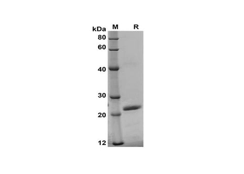 SDS-PAGE analysis of Mouse CD96/TACTILE proteins, 2 μg/lane of Recombinant Mouse CD96/TACTILE proteins was resolved with SDS-PAGE under reducing conditions, showing bands at 22 kDa.