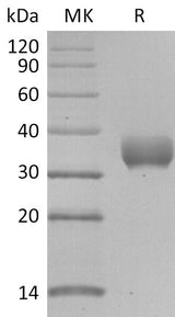 Recombinant SARS-CoV-2 Spike RBD (R408I)(His Tag) - ABMIUM