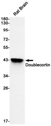 Western blot detection of Doublecortin in Rat Brain cell using Doublecortin Rabbit mAb(1:1000 diluted).Predicted band size:41kDa.Observed band size:41kDa.