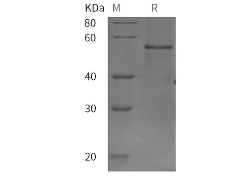SDS-PAGE analysis of Rat IL7R/IL-7R/CD127 proteins, 2 μg/lane of Recombinant Rat IL7R/IL-7R/CD127 proteins was resolved with SDS-PAGE under reducing conditions, showing bands at 50 kDa.