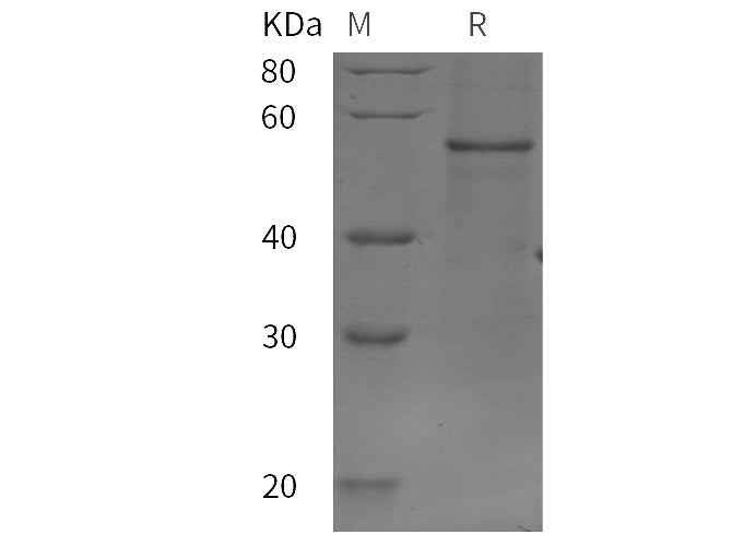 SDS-PAGE analysis of Rat IL7R/IL-7R/CD127 proteins, 2 μg/lane of Recombinant Rat IL7R/IL-7R/CD127 proteins was resolved with SDS-PAGE under reducing conditions, showing bands at 50 kDa.