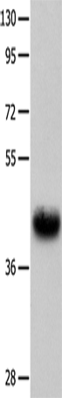Anti-Human UTS2R Antibody - ABMIUM