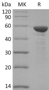 Recombinant SARS-CoV-2 N Protein biotinylated(N-6His-Avi) - ABMIUM