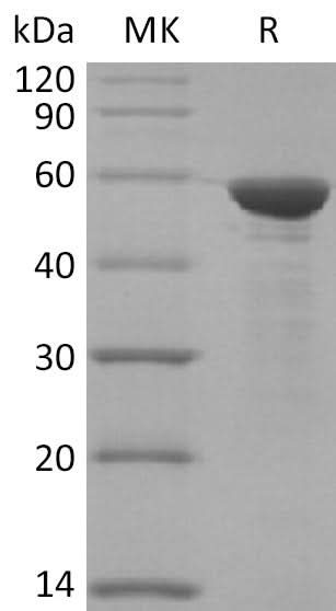 Recombinant SARS-CoV-2 N Protein biotinylated(N-6His-Avi) - ABMIUM