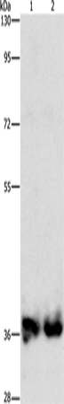 Anti-Human/Mouse/Rat ASPA Antibody - ABMIUM