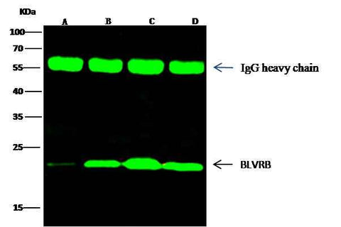 Anti-Human BLVRB Antibody [B183] - ABMIUM