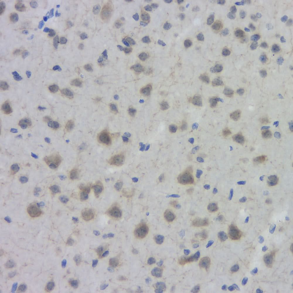 Immunohistochemistry analysis of paraffin-embedded mouse brain using ACHE Polyclonal Antibody at dilution of 1:300.