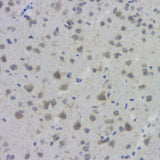 Immunohistochemistry analysis of paraffin-embedded mouse brain using ACHE Polyclonal Antibody at dilution of 1:300.