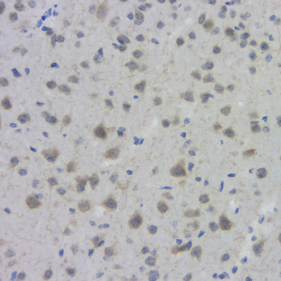 Immunohistochemistry analysis of paraffin-embedded mouse brain using ACHE Polyclonal Antibody at dilution of 1:300.