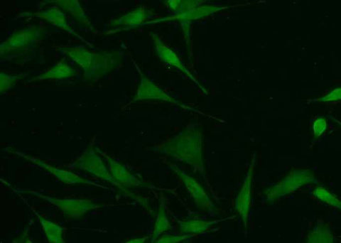 Anti-Human CMPK1 Antibody [A1088] - ABMIUM