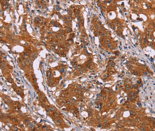 Anti-Human/Mouse DCTN6 Antibody - ABMIUM
