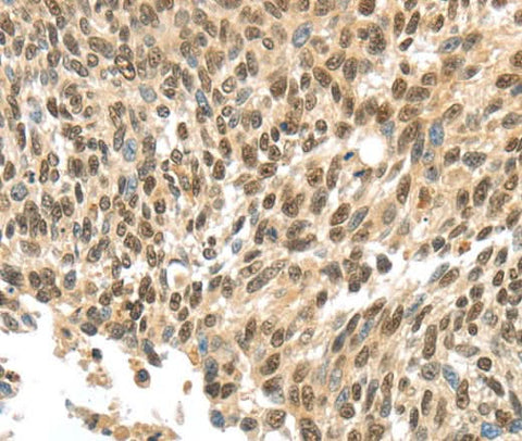Anti-Human APOL6 Antibody - ABMIUM