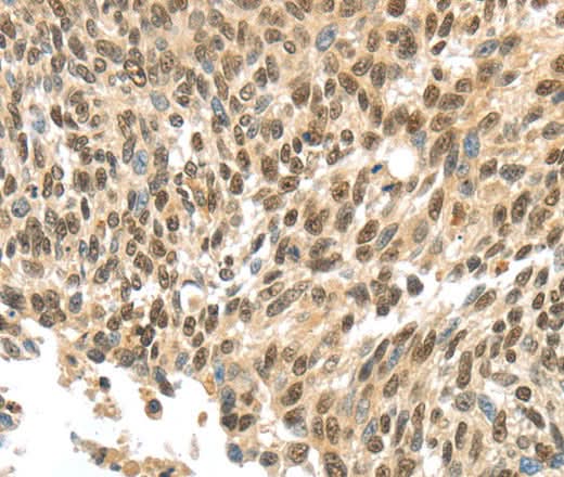 Anti-Human APOL6 Antibody - ABMIUM