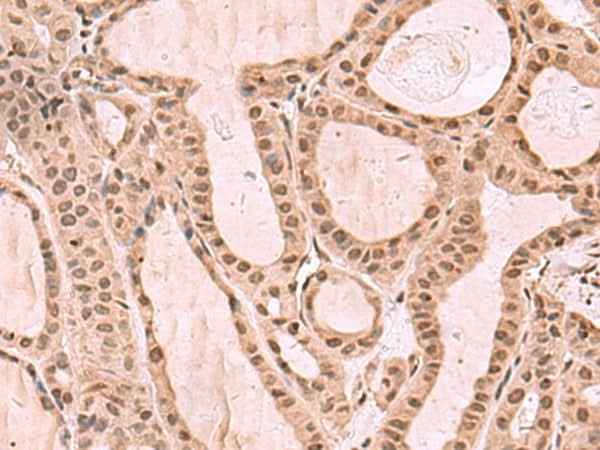 Anti-Human/Mouse KDM7A Antibody