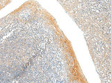 Immunohistochemistry of paraffin-embedded Human tonsil tissue using FAM110D Polyclonal Antibody at dilution of 1:60(×200)