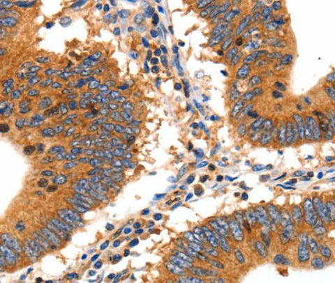 Anti-Human SLC2A2 Antibody - ABMIUM