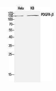 Anti-Human/Mouse/Rat PDGFRB Antibody
