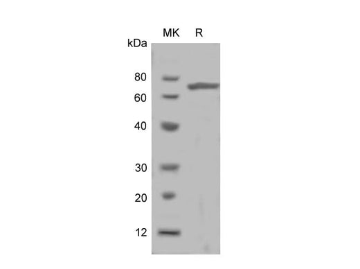 SDS-PAGE analysis of Rat Growth Hormone Receptor/GHR proteins, 2 μg/lane of Recombinant Rat Growth Hormone Receptor/GHR proteins was resolved with SDS-PAGE under reducing conditions, showing bands at 36 kDa.