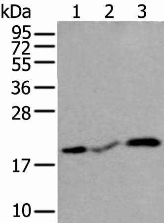 Anti-Human/Mouse/Rat CSRP3 Antibody