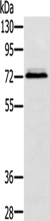 Anti-Human SSX2IP Antibody - ABMIUM