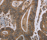 Anti-Human MRGPRX1 Antibody - ABMIUM