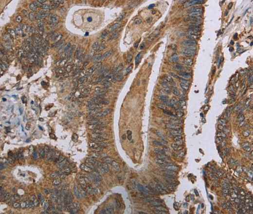 Anti-Human MRGPRX1 Antibody