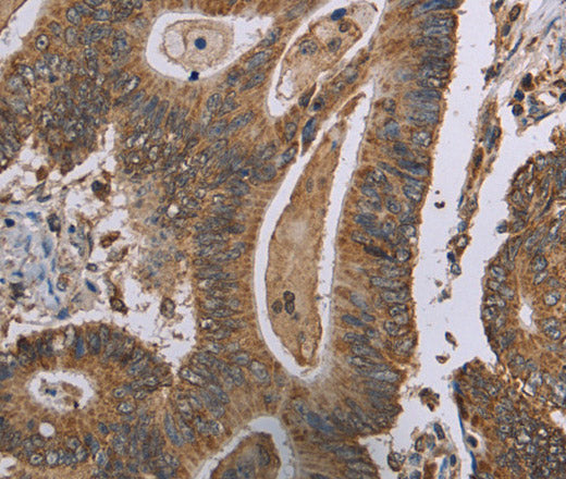 Anti-Human MRGPRX1 Antibody - ABMIUM