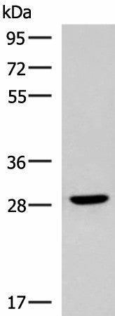 Western blot analysis of Human fetal brain tissue lysate using CLEC9A Polyclonal Antibody at dilution of 1:800
