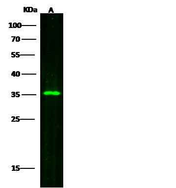 Anti-Human SULT2A1 Antibody [A915] - ABMIUM