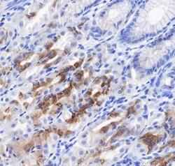 Anti-Human Gastric Mucin-6/MUC6 Antibody [A483] - ABMIUM